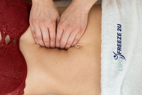 diastasis recti treatment Wallingford