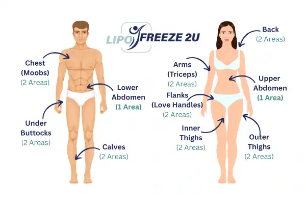 Areas you can have fat freezing treatment Wallingford
