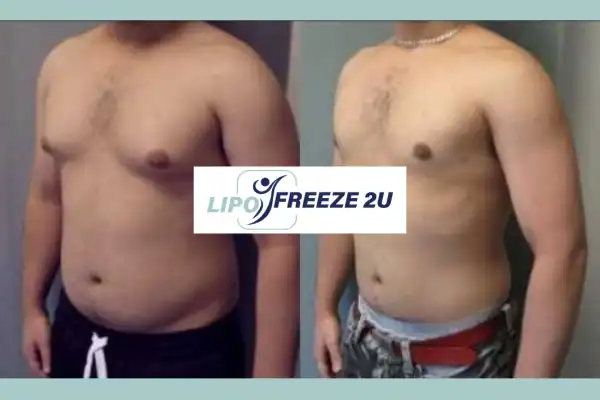 How Long Does It Take to See Results Wallingford?