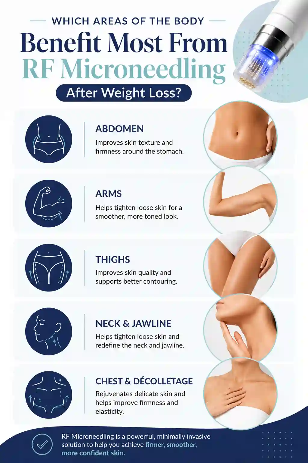 Which Areas of the Body Benefit Most From RF Microneedling After Weight Loss Wallingford